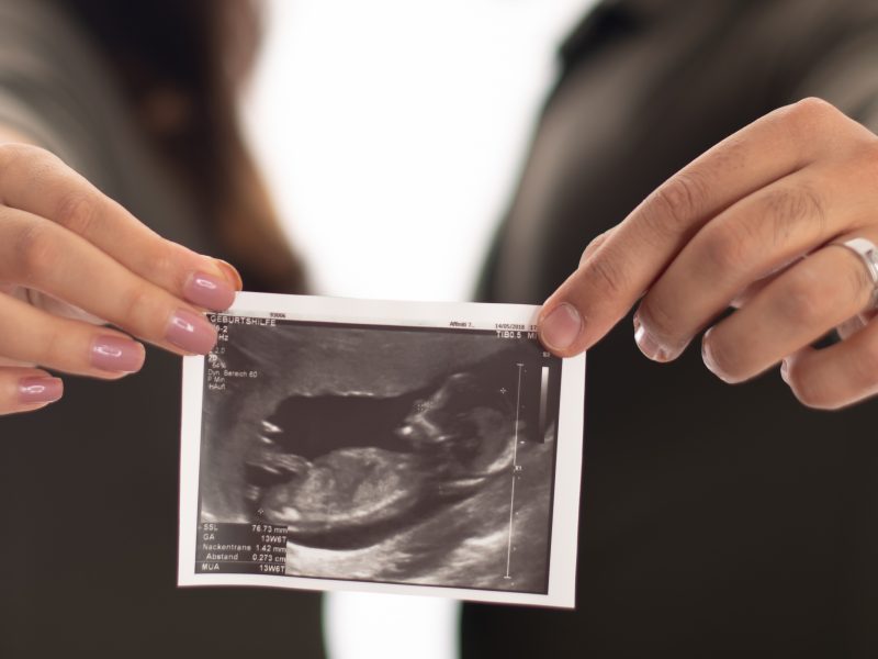 Hamburg wächst: 11.049 Kinder im ersten Halbjahr 2023 geboren